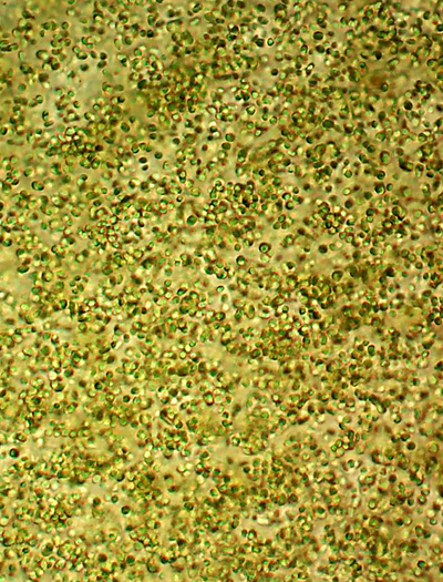 ROTIFER DIET™